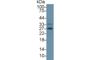 Western Blot; Sample: Human Hela cell lysate; Primary Ab: 2µg/ml Rabbit Anti-Gallus ADP Antibody Second Ab: 0. (ADIPOQ anticorps  (AA 32-244))