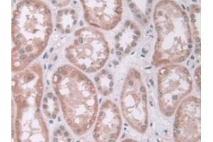 DAB staining on IHC-P;;Samples: Human Kidney Tissue (IDUA anticorps  (AA 28-306))