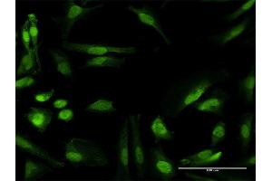 Immunofluorescence of purified MaxPab antibody to RANBP6 on HeLa cell. (RANBP6 anticorps  (AA 1-1105))