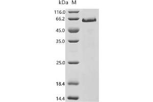Notch 1 (NOTCH1) (AA 19-526) protein (His tag)