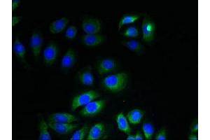 Immunofluorescent analysis of A549 cells using ABIN7156381 at dilution of 1:100 and Alexa Fluor 488-congugated AffiniPure Goat Anti-Rabbit IgG(H+L) (ITM2A anticorps  (AA 79-263))