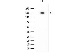 Western blot analysis of lysates from Rat testis, using Collagen IV alpha 2 Mouse Monoclonal Antibody at 1/1000 dilution.
