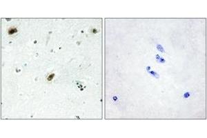 Immunohistochemistry analysis of paraffin-embedded human brain tissue, using ABL1 Antibody. (ABL1 anticorps  (AA 861-910))