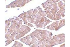 Immunohistochemistry of TRPC3 in mouse heart tissue with this product at 2 μg/ml. (TRPC3 anticorps  (C-Term))