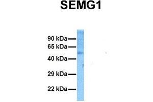 Host:  Rabbit  Target Name:  SEMG1  Sample Tissue:  Human Ovary Tumor  Antibody Dilution:  1. (SEMG1 anticorps  (N-Term))