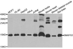 Western blot analysis of extracts of various cell lines, using SNRPD2 antibody. (SNRPD2 anticorps)