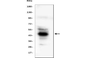 Western blot analysis of HP using anti-HP antibody (ABIN7600401).