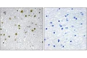 Immunohistochemistry analysis of paraffin-embedded human brain tissue, using NRIP2 Antibody. (NRIP2 anticorps  (AA 1-50))