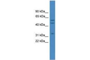 Image no. 1 for anti-ELK1, Member of ETS Oncogene Family (ELK1) (AA 301-350) antibody (ABIN6745314) (ELK1 anticorps  (AA 301-350))
