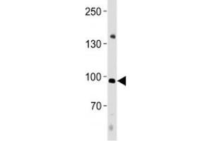 NFATC4 antibody western blot analysis in human placenta tissue lysate. (NFATC4 anticorps  (AA 744-773))