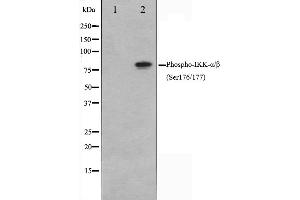 Western blot analysis of IKK alpha /IKK beta phosphorylation expression in TNF treated NIH-3T3 whole cell lysates,The lane on the left is treated with the antigen-specific peptide.