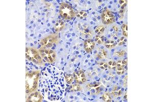 Immunohistochemistry of paraffin-embedded Rat kidney using GIP antibody at dilution of 1:100 (x400 lens). (GIP anticorps)
