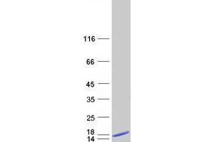 Validation with Western Blot