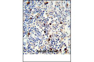 Lambda light chain Antibody (ABIN1539834 and ABIN2843347) immunohistochemistry analysis in formalin fixed and paraffin embedded human lymph tissue followed by peroxidase conjμgation of the secondary antibody and DAB staining. (Lambda-IgLC anticorps)