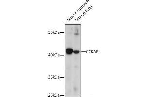 Western blot analysis of extracts of various cell lines using CCKAR Polyclonal Antibody at dilution of 1:1000. (CCKAR anticorps)
