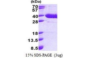 SDS-PAGE (SDS) image for Nuclear Factor of kappa Light Polypeptide Gene Enhancer in B-Cells Inhibitor, delta (NFKBID) (AA 1-313) protein (His tag) (ABIN5853211) (NFKBID Protein (AA 1-313) (His tag))