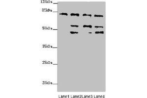 Western blot All lanes: ZFYVE1 antibody at 6. (ZFYVE1 anticorps  (AA 1-280))