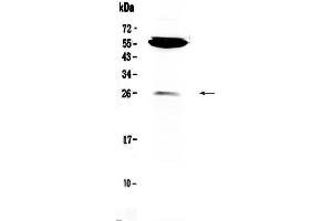 Western blot analysis of CTLA4 using anti-CTLA4 antibody . (CTLA4 anticorps  (AA 36-161))