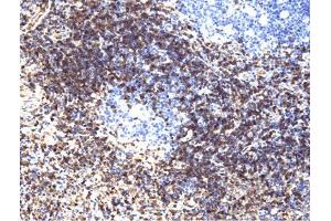 LAT (pY226) staining on tonsil.