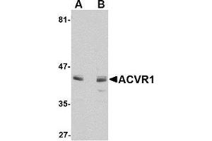 Western blot analysis of ACVR1 in A549 cell lysate with AP30014PU-N ACVR1 antibody at 1 μg/ml in (A) the absence and (B) the presence of blocking peptide.
