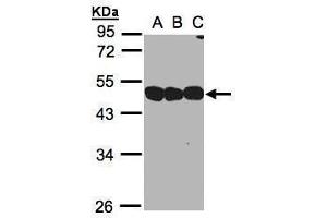 WB Image Sample(30 ug whole cell lysate) A:293T B:A431, C:H1299 10% SDS PAGE antibody diluted at 1:1000