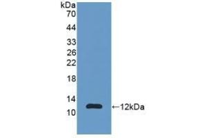 Detection of Recombinant S100A11, Human using Polyclonal Antibody to S100 Calcium Binding Protein A11 (S100A11) (S100A11 anticorps  (AA 1-105))