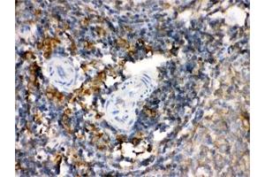 IHC-P: TGM2 antibody testing of rat spleen tissue