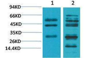 Western Blotting (WB) image for anti-Transforming Growth Factor, beta 1 (TGFB1) antibody (ABIN3181578) (TGFB1 anticorps)