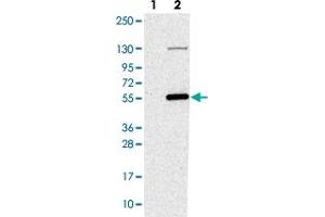Western blot analysis of Lane 1: Negative control (vector only transfected HEK293T lysate). (NAT16 anticorps)