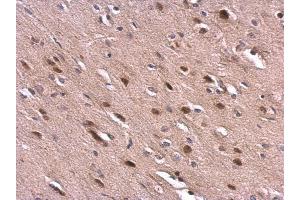 IHC-P Image VHL antibody detects VHL protein at cytosol and nucleus on rat fore brain by immunohistochemical analysis.