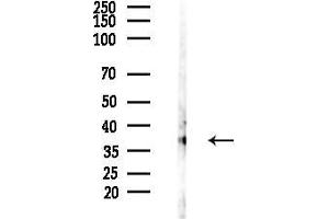 anti-Gonadotropin-Releasing Hormone Receptor (GNRHR) (N-Term) antibody