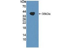 Detection of Recombinant TRPA1, Human using Polyclonal Antibody to Transient Receptor Potential Cation Channel Subfamily A, Member 1 (TRPA1)