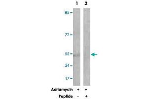 Western blot analysis of extracts from HUVEC cells, treated with Adriamycin (0. (Caspase 2 anticorps  (Ser140))
