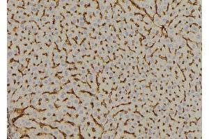 ABIN6269059 at 1/100 staining Mouse liver tissue by IHC-P. (DOK2 anticorps  (Internal Region))