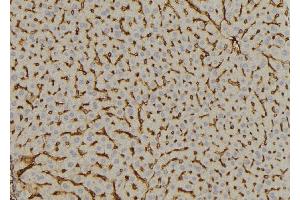 ABIN6269059 at 1/100 staining Mouse liver tissue by IHC-P.