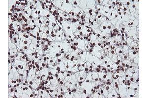 Image no. 9 for anti-Exosome Component 7 (EXOSC7) antibody (ABIN1498140)