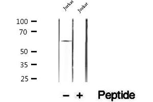 Western blot analysis of extracts of Jurkat cells, using HPSE antibody. (HPSE anticorps  (Internal Region))