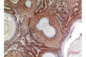 Immunohistochemistry (IHC) analysis of paraffin-embedded Human Skin, antibody was diluted at 1:100. (INHBB anticorps  (C-Term))