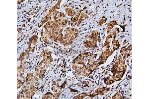 IHC analysis of RNF169 using anti-RNF169 antibody (ABIN6719530).