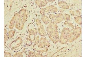 Immunohistochemistry of paraffin-embedded human pancreatic tissue using ABIN7149799 at dilution of 1:100 (DET1 anticorps  (AA 15-240))
