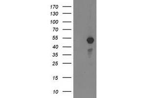 Western Blotting (WB) image for anti-Myocyte Enhancer Factor 2C (MEF2C) antibody (ABIN1499362)