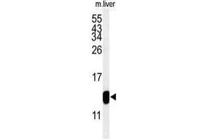Western blot analysis of TMIE Antibody (Center) in mouse liver tissue lysates (35 µg/lane). (TMIE anticorps  (Middle Region))