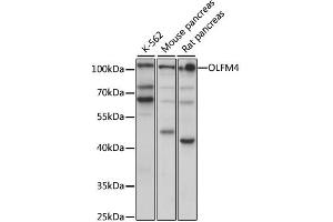 Western blot analysis of extracts of various cell lines, using OLFM4 antibody (ABIN6290716) at 1:1000 dilution.