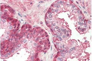 ABIN570703 (5µg/ml) staining of paraffin embedded Human Prostate.