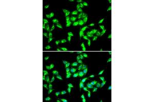 Immunofluorescence analysis of HeLa cell using ANTXR1 antibody. (ANTXR1 anticorps)