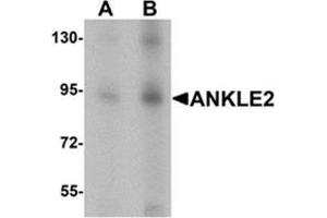Western blot analysis of ANKLE2 in SW480 cell lysate with ANKLE2 antibody at (A) 1 and (B) 2 ug/mL. (ANKLE2 anticorps  (Middle Region))