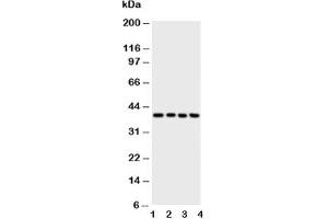 Western blot testing of ATF4 antibody and Lane 1:  A431;  2: Raji;  3: CEM;  4: HUT cell lysate