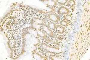 Immunohistochemistry analysis of paraffin-embedded fetal mouse using,PNN (ABIN7075083) at dilution of 1: 1200