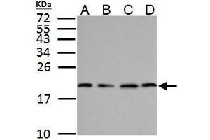 WB Image SOD1 antibody detects SOD1 protein by Western blot analysis. (SOD1 anticorps  (C-Term))