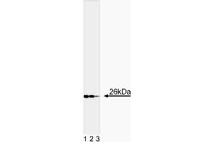 Western blot analysis of Bcl-2 (Second Panel). (Bcl-2 anticorps  (AA 41-54))